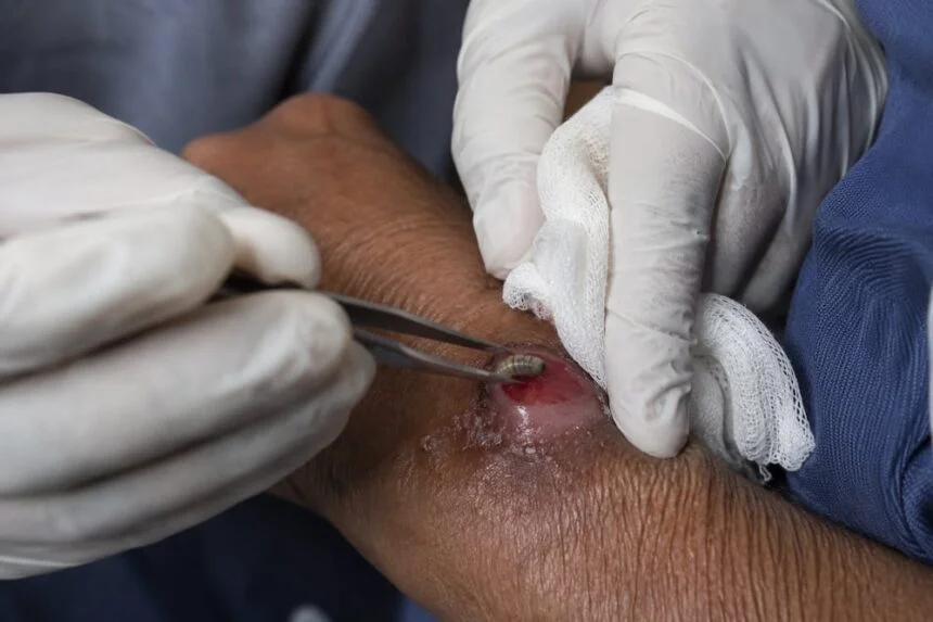 Adds 1 death due to screwworm in Querétaro