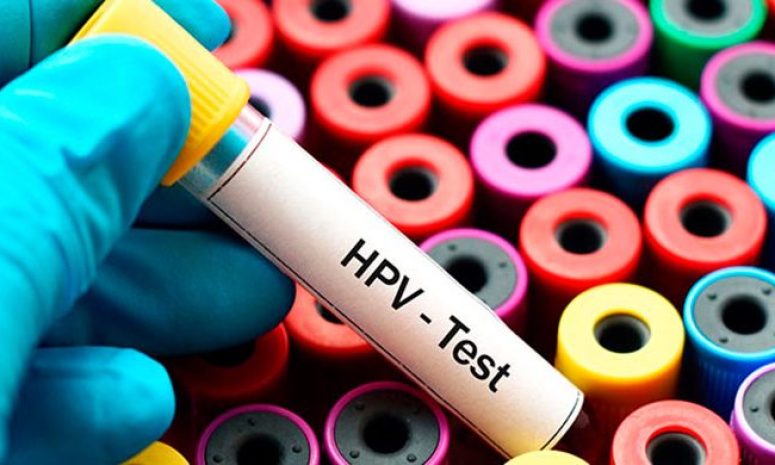 VPH: una infección frecuente relacionada con varios tipos de cáncer